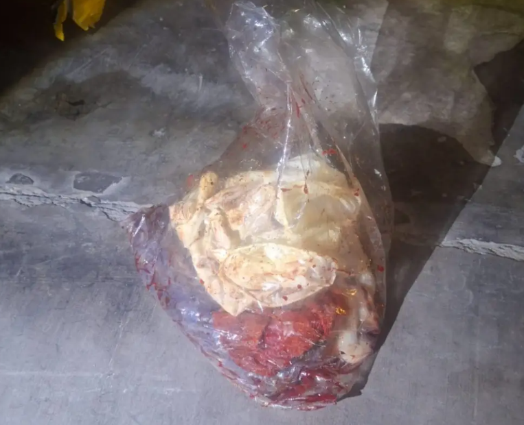 CLAUSURARON LA CLÍNICA IMAC EN SALTA: Por arrojar residuos patogénicos en plena calle