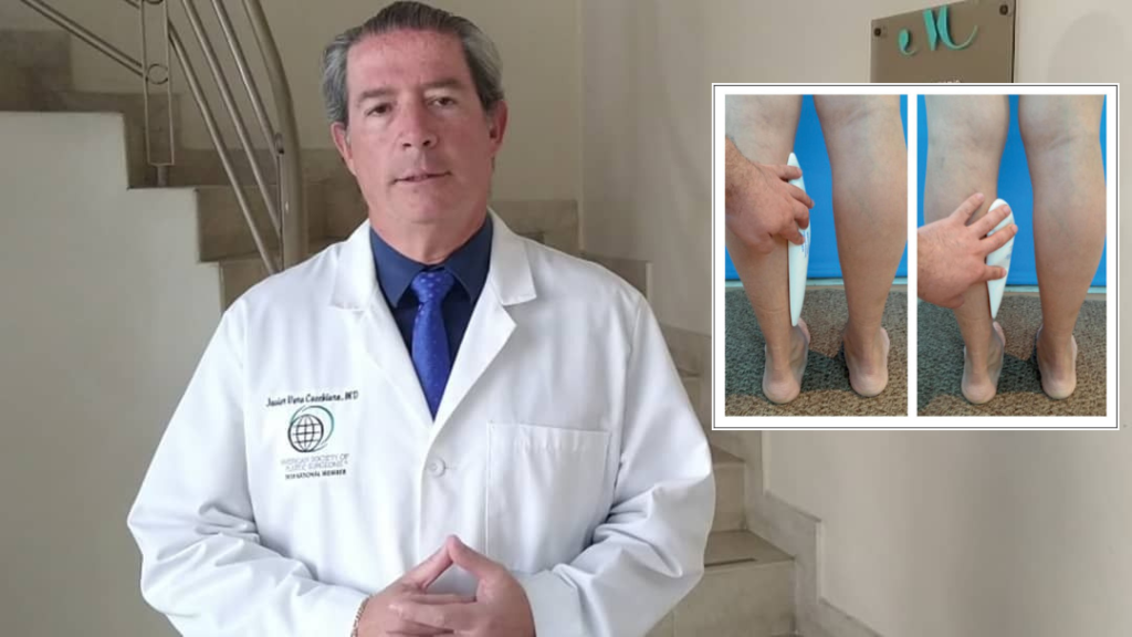 MITOS Y REALIDADES DE LOS IMPLANTES DE PANTORRILLA