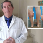 MITOS Y REALIDADES DE LOS IMPLANTES DE PANTORRILLA