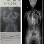 Si no hay Estado los pobres quedan afuera: Por Francisco «Paco» Olveira