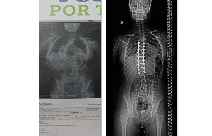 Si no hay Estado los pobres quedan afuera: Por Francisco «Paco» Olveira