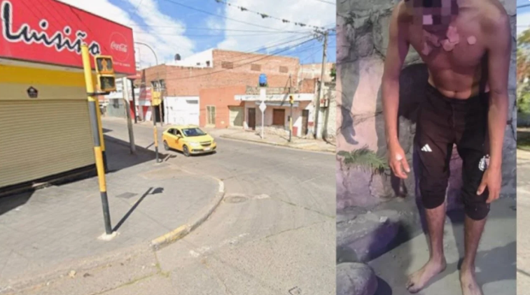 Jujuy: Dormía en la calle y lo prendieron fuego, una detenida